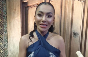 Denada Usai Operasi Hidung